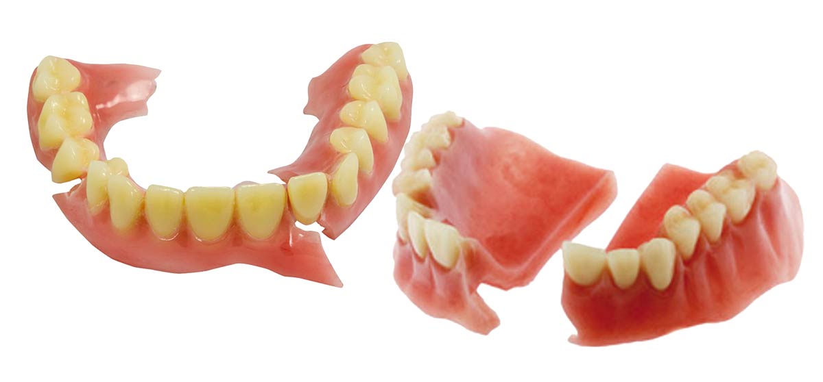 riparazione protesi dentali roma 